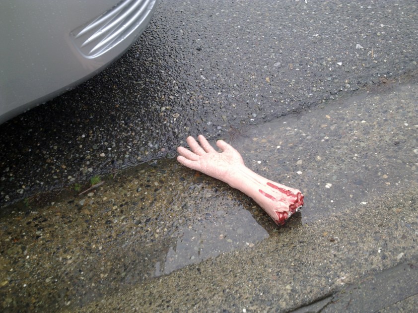 severed hand